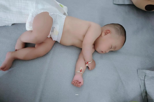 海东宝宝脸上有白色斑块